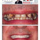 Grove City Dental