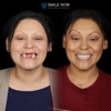 Smile Now Boise Dentures and Implants gallery