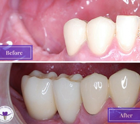 Dr. Orest Frangopol, DDS - Mission Viejo, CA