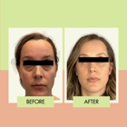Adonis Plastic Surgery