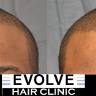 Evolve Hair Clinic