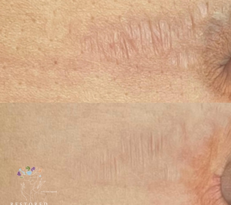 Restored Cosmetics (Medical Tattooing & Permanent Makeup) - Alpharetta, GA