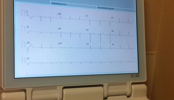 West Valley Hospital - Goodyear, AZ. This is a ecg that looked messed up my son has a heart condition so im familliar i know this is wrong