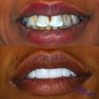 DentaCrafters P
