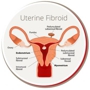 USA Fibroid Center