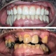 Four Ever Smile Dental Implant Center