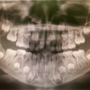 Boise Oral and Maxillofacial Surgery gallery