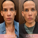 Allure Aesthetics RN - Beauty Salons