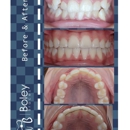 Boley Braces - Orthodontists