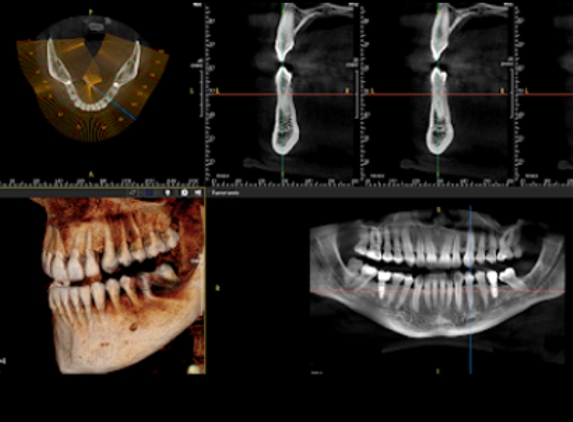 Carolina Dentistry & Dentures Greensboro - Greensboro, NC