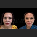 Inspire Aesthetics - Physicians & Surgeons, Cosmetic Surgery