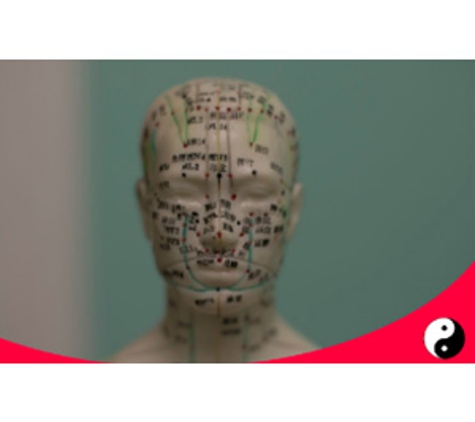 Centre of Chinese Acupuncture - North Perth, WA