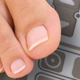 Laser Nail Therapy Clinic-Toenail Fungus Treatment Tampa FL