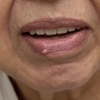 Fulton Dental Associates gallery