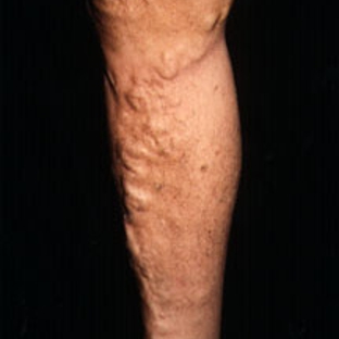 Schulman, Lee, MD     Schulman Vein And Laser Center - Manhasset, NY