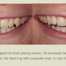 Facer Hales Parker Dentistry | Veneers - Implants - Comprehensive - Cosmetic Dentistry