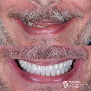 Florida Dental Implant Studio - Ponte Vedra Beach, FL