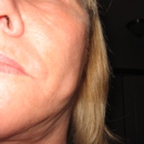 Greenville Plastic Surgery - Physicians & Surgeons, Cosmetic Surgery