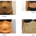 Liposuction and Cosmetic Surgery Institute