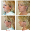 Utah Facial Plastics & UFP Aesthetics - Physicians & Surgeons, Cosmetic Surgery