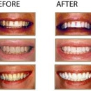 Belmar Park Dental Care, PC - Dentists