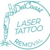 DelCoast Laser Tattoo Removal gallery