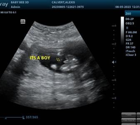 (Arlington) Baby Bee 3D Ultrasound + Studio - Arlington, TX