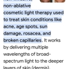 Laser Essential gallery