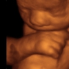 3D 4D Baby Breath Ultrasound Studio gallery