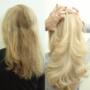 Boston Beauty MedSpa - Hair Replacement