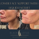Black Lotus Wellness & Aesthetics - Day Spas