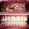 Elgin Dental Implants gallery