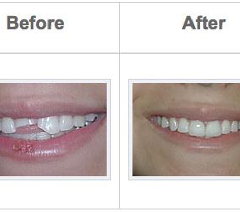 Forero Family & Implant Dentistry - Coral Springs, FL