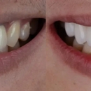 Elegant Dentistry - Implant Dentistry