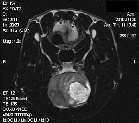 Companion MRI (CICNE) - W Hartford, CT