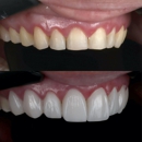 Gables iSmile - Cosmetic Dentistry