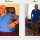 Advanced Bariatric and Surgical Specialists