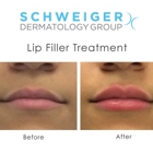 Schweiger Dermatology Group