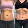 Wymore Laser & Anti-Aging Medicine in Winter Park, FL gallery