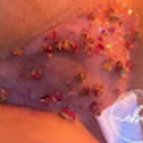 Enhance Beautiful Skin - Hair Removal