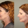 Kalos Facial Plastic Surgery LLC gallery