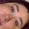 Allure Infinite Beauty gallery