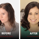 Hair Club for Men and Women - Hair Replacement