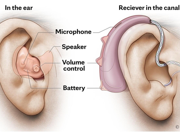 Mayo Clinic Hearing Aid Clinic - Jacksonville, FL