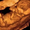 Fetal Memories 2D 3D 4D Ultrasound gallery