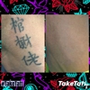 TakeTatt Tattoo Removal gallery