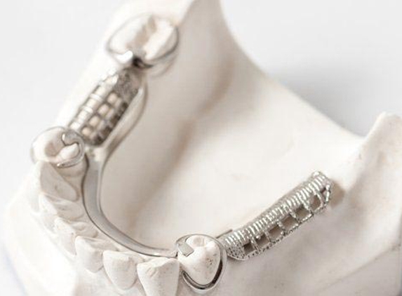 Total Denture Care Clinics - Kingston, TAS