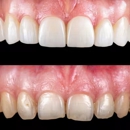 Old Moreland Dental - Implant Dentistry