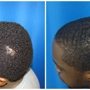 Houston Hair Transplant Center