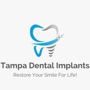 Tampa Dental Implants